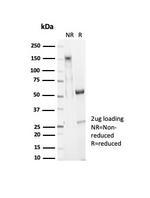 SMAD4/DPC4 (Pancreatic Adenocarcinoma Marker/Tumor Suppressor) Antibody in Immunohistochemistry (IHC)