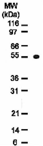 Osteoprotegerin (OPG) Antibody in Western Blot (WB)