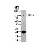 HDAC4 Antibody in Western Blot (WB)