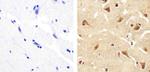 ANGPTL4 Antibody in Immunohistochemistry (Paraffin) (IHC (P))