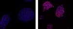 Rat IgG2a kappa Isotype Control in Immunocytochemistry (ICC/IF)