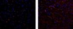 Mouse IgG1 kappa Isotype Control in Immunohistochemistry (Paraffin) (IHC (P))