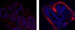 Mouse IgG1 kappa Isotype Control in Immunohistochemistry (Paraffin) (IHC (P))