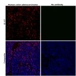 Ki-67 Antibody in Immunohistochemistry (Paraffin) (IHC (P))