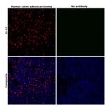 Ki-67 Antibody in Immunohistochemistry (Paraffin) (IHC (P))