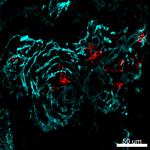 Alpha-Smooth Muscle Actin Antibody in Immunohistochemistry (IHC)