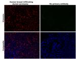 Vimentin Antibody in Immunohistochemistry (Paraffin) (IHC (P))