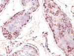 MAGE-1 (Target for Cancer Immunotherapy) Antibody in Immunohistochemistry (Paraffin) (IHC (P))