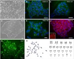 OCT4 Antibody in Immunocytochemistry (ICC/IF)