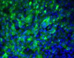 TRA-1-60 Antibody in Immunocytochemistry (ICC/IF)