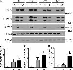 SRC3 Antibody in Western Blot (WB)