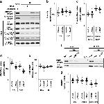 DNM1L Antibody in Western Blot (WB)