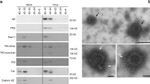 Clathrin Heavy Chain Antibody in Western Blot (WB)