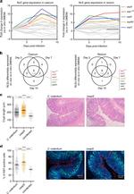 Ki-67 Antibody in Immunohistochemistry (IHC)