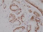 Androgen Receptor Antibody in Immunohistochemistry (Paraffin) (IHC (P))