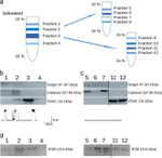 Golgin-97 Antibody in Western Blot (WB)