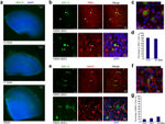 MAP2 Antibody in Immunohistochemistry (IHC)