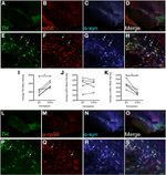 alpha Synuclein Antibody in Immunohistochemistry (IHC)