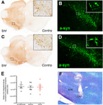 alpha Synuclein Antibody in Immunohistochemistry (IHC)