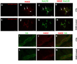 HuC/HuD Antibody in Immunohistochemistry (IHC)