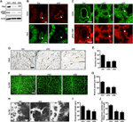 Phospho-FAK (Tyr397) Antibody in Immunohistochemistry (IHC)