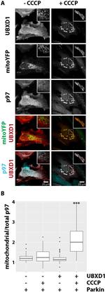 VCP Antibody in Immunocytochemistry (ICC/IF)