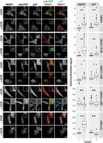 VCP Antibody in Immunocytochemistry (ICC/IF)