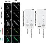 VCP Antibody in Immunocytochemistry (ICC/IF)