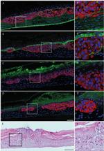 PMEL Antibody in Immunohistochemistry (IHC)