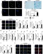 NFkB p65 Antibody in Immunocytochemistry (ICC/IF)