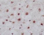 FXR Antibody in Immunohistochemistry (Frozen) (IHC (F))