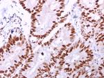 MCM6 (Proliferation Marker) Antibody in Immunohistochemistry (Paraffin) (IHC (P))