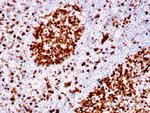 MCM6 (Proliferation Marker) Antibody in Immunohistochemistry (Paraffin) (IHC (P))