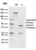 MCM7 Antibody in SDS-PAGE (SDS-PAGE)