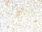 MDM2 Antibody in Immunohistochemistry (Paraffin) (IHC (P))