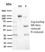 MDM2 Antibody in SDS-PAGE (SDS-PAGE)