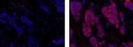 Mouse IgG1 kappa Isotype Control in Immunohistochemistry (Paraffin) (IHC (P))