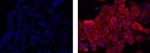 Pan Cytokeratin Antibody in Immunocytochemistry (ICC/IF)