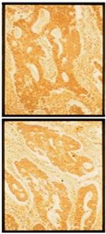 Fibronectin Antibody in Immunohistochemistry (Paraffin) (IHC (P))