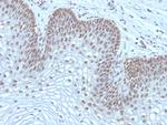 MAP3K1 (Mitogen-Activated Protein Kinase Kinase Kinase 1) Antibody in Immunohistochemistry (Paraffin) (IHC (P))