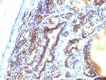 MAP3K1 (Mitogen-Activated Protein Kinase Kinase Kinase 1) Antibody in Immunohistochemistry (Paraffin) (IHC (P))