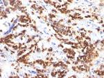 Milk Fat Globule (Breast Epithelial Marker) Antibody in Immunohistochemistry (Paraffin) (IHC (P))