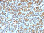 Milk Fat Globule (Breast Epithelial Marker) Antibody in Immunohistochemistry (Paraffin) (IHC (P))