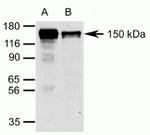 Raptor Antibody in Immunoprecipitation (IP)