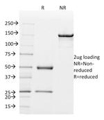 Mammaglobin (SCGB2A2) (Breast Cancer Marker) Antibody in SDS-PAGE (SDS-PAGE)