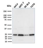 Mammaglobin (SCGB2A2) (Breast Cancer Marker) Antibody in Western Blot (WB)