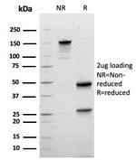 Mammaglobin (SCGB2A2) (Breast Cancer Marker) Antibody in SDS-PAGE (SDS-PAGE)