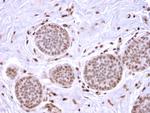 Mammaglobin (SCGB2A2) (Breast Cancer Marker) Antibody in Immunohistochemistry (Paraffin) (IHC (P))