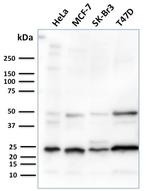 Mammaglobin (SCGB2A2) (Breast Cancer Marker) Antibody in Western Blot (WB)