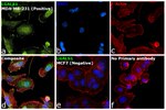 Galectin 1 Antibody in Immunocytochemistry (ICC/IF)